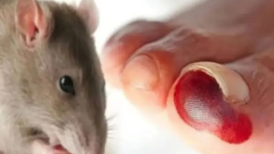 Dokter Ungkap Gejala Mematikan Infeksi Virus Hanta dari Kotoran Tikus